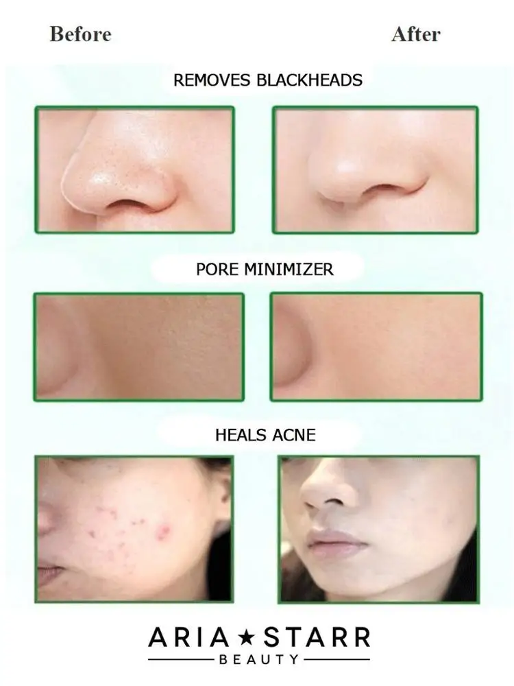 Private Label Skin Care Natural Organic Charcoal Moisturizing Matcha Dead Sea Mud Mask