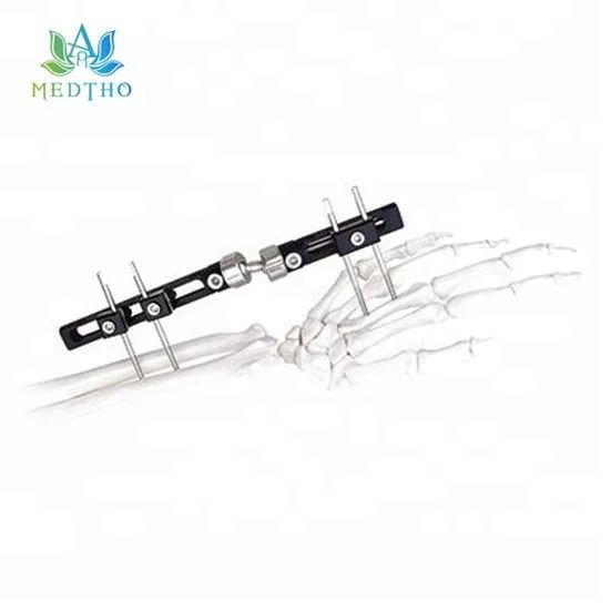 
orthopedic external fixation system external fixator Wrist Joints External Fixator 