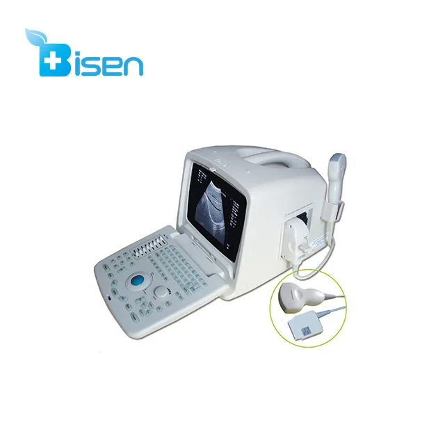 Дешевый мощный функциональный ультразвуковой сканер с выпуклым зондом красивый и портативный внешний