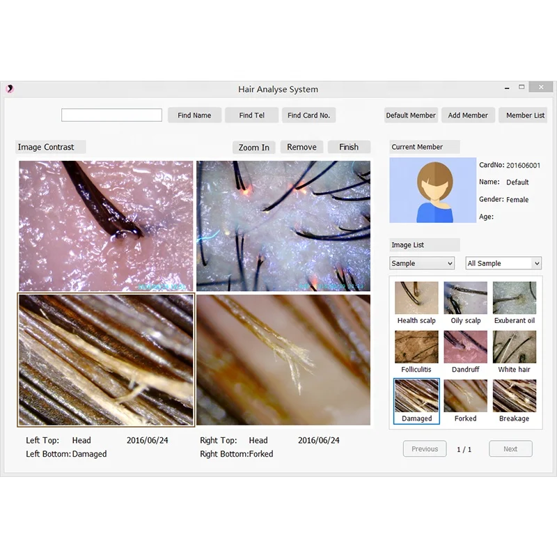 High Quality 8.0 MP HD USB Hair Scalp Scope analyzer