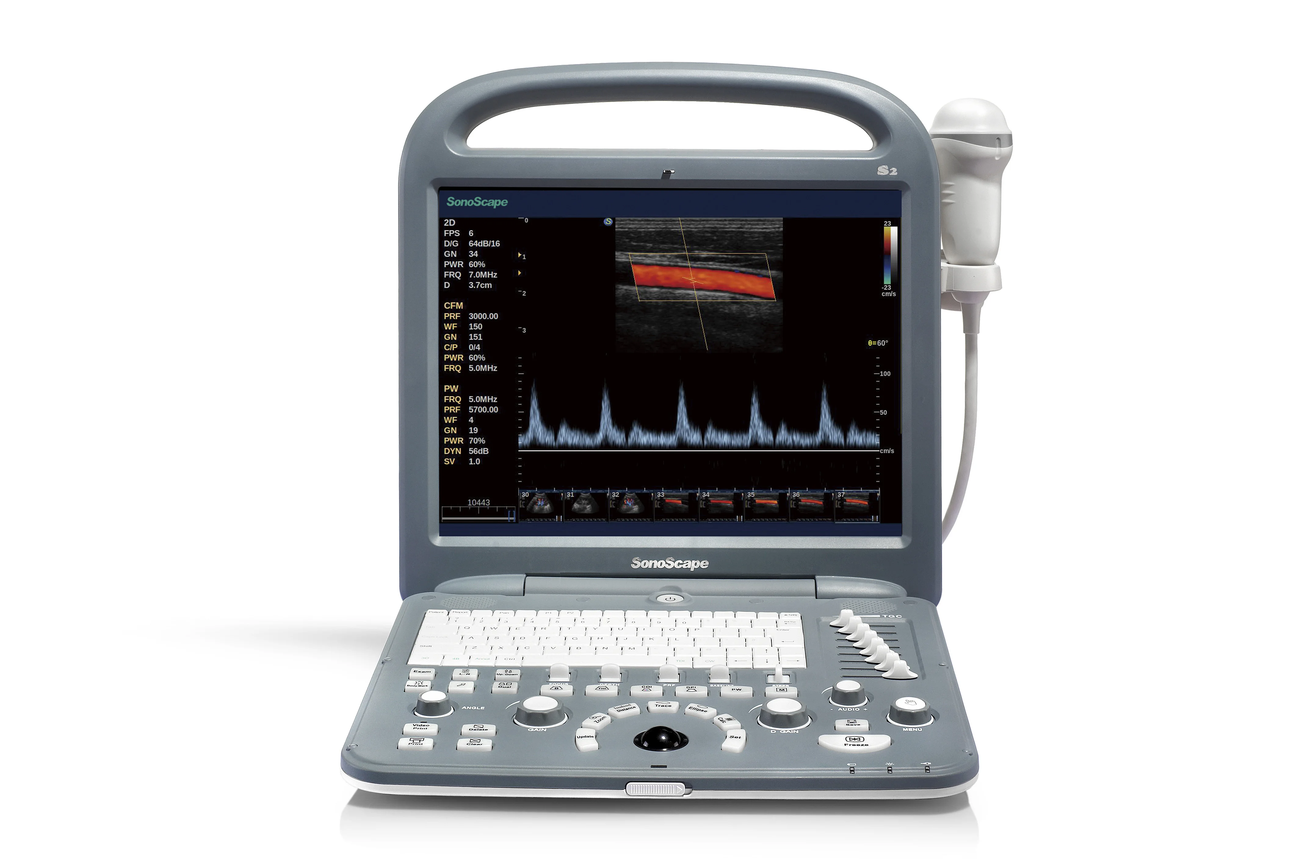Famous color doppler ultrasound machine sonoscape p20 price