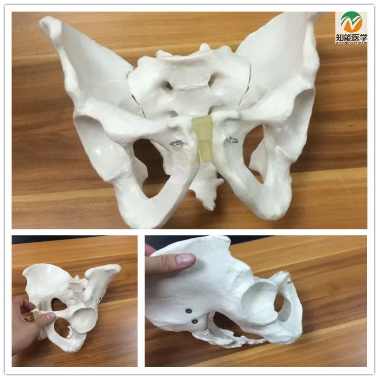 Medical Science Male Pelvic Anatomic model for Disease Demonstration Medical Teaching Tool