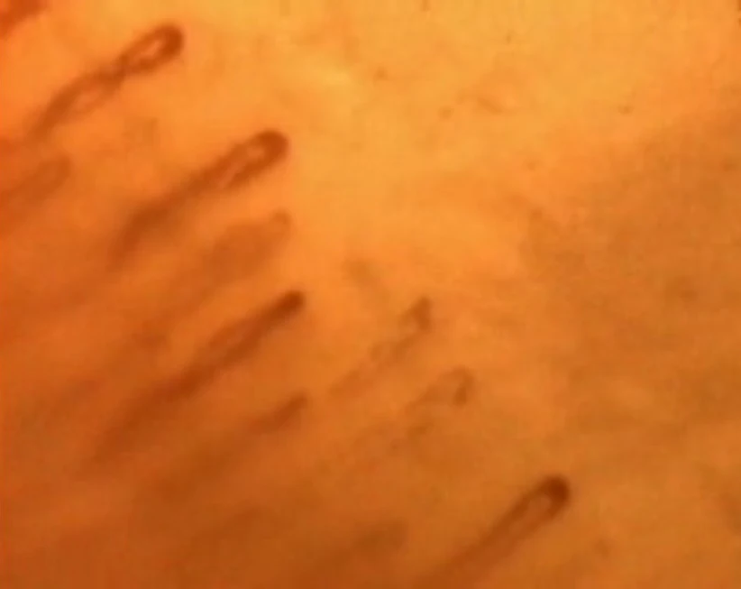 LCD Screen Digital Capillary Microcirculation Microscope