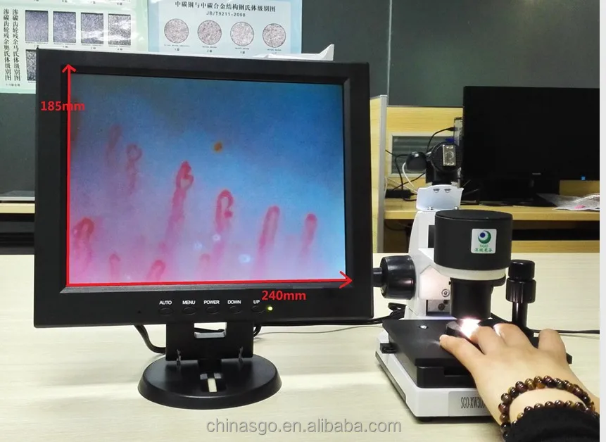 Microcirculation detecting instrument health instrument