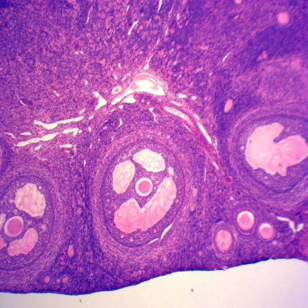 Teaching resources Medical science histology prepared microscope slides/Ovary of Rabbit sec histology prepared slides