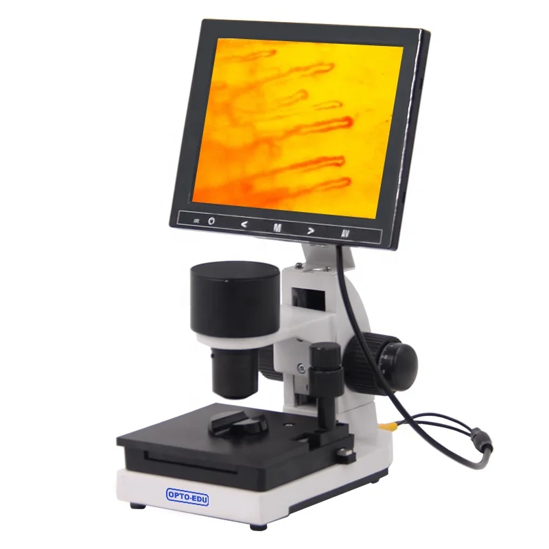 OPTO-EDU A33.0220 8' LCD Noninvasive Nail Microcirculation Checking Microscope