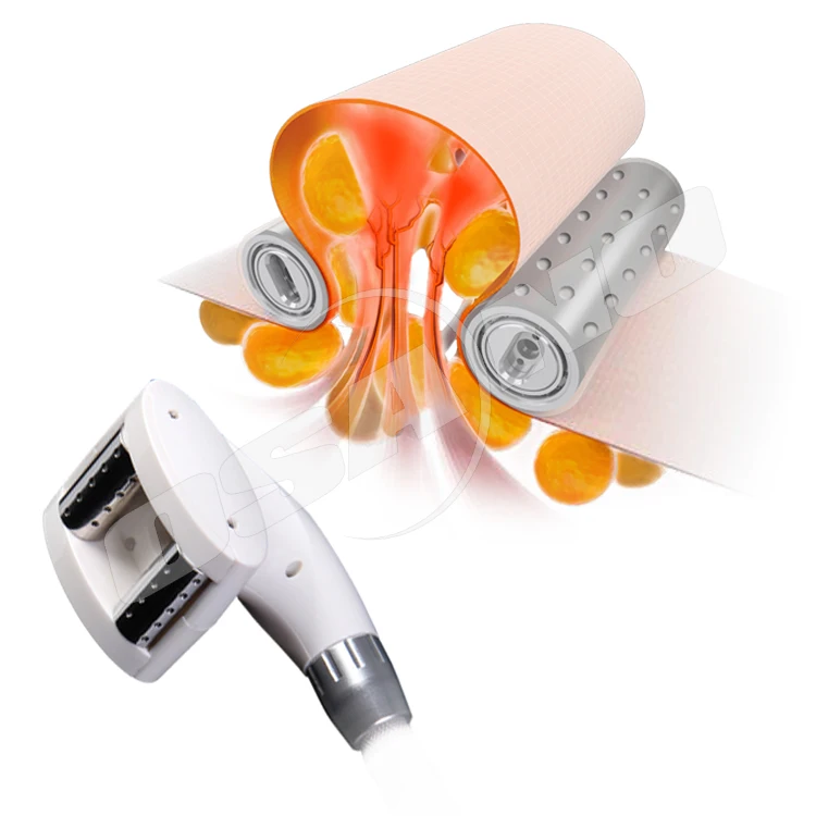 multi-functional beauty equipment lipolaser vacuum cavitation system rf skin tightening velasmooth machine