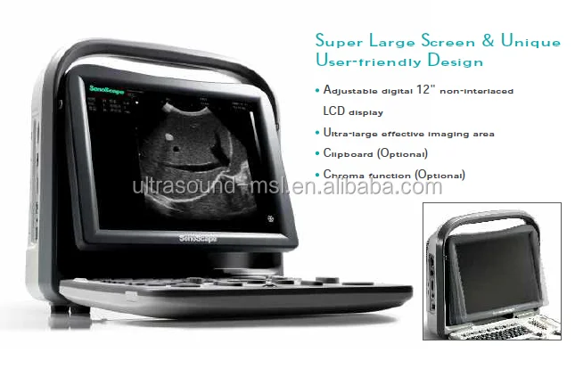 Sonoscape A5V B/W портативная ветеринарная ультразвуковая машина