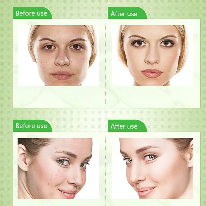 DR.RASHEL Smooth Anti Wrinkle Whitening Aloe Vera Smooth Anti Acne Pimple Cream