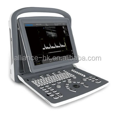 Chison ECO2 Echography Portable Black and White Ultrasound with Doppler Ecografia