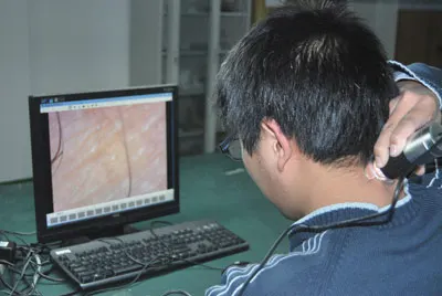 Patent portable USB digital skin microscope for skin analyze