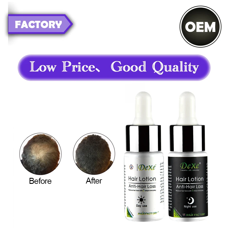 Oem/odm Dexe Anti Hair Loss Lotion Wholesale Best Herbal Grow Hair Lotion Buy Anti Hair Loss Lotion