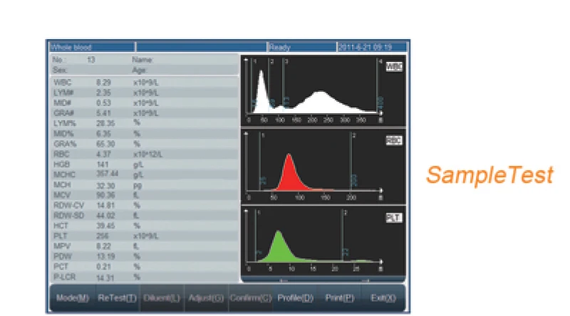 Rayto rt 7600 auto hematology analyzer/3 part hematology analyzer