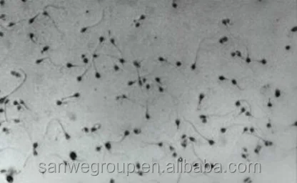 SW-3702  Portable Laptop Semen Analyzer