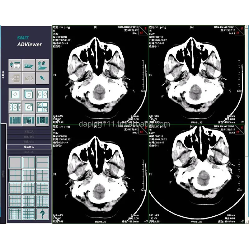 
Software Of CT Workstation 