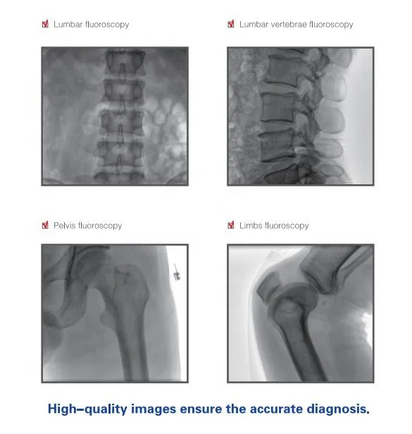 BT-XC06 Grayscale LCD display 9' Dynamic Flat Panel Detector surgical orthopedic c-arm radiation exposure equipment c arm x-ray