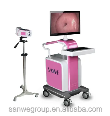 SW-3304 Digital Video Colposcope, Vaginal Colposcope with Camera, Video Colposcope