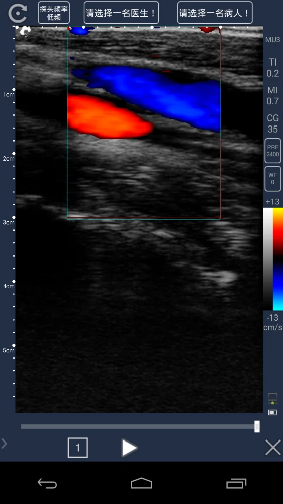 TOP-A1025 portable 4d color doppler ultrasound scanner system usb