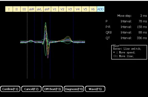 EM-1201B ECGMAC Medical 12 channels ECG machine Foldable ECG