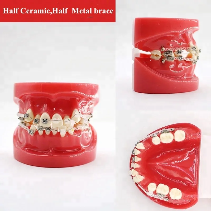 ALS Dental ceramic orthodontic Braces tooth model with Bracket