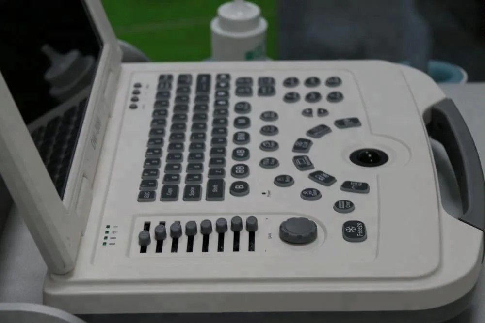 laptop ultrasound machine& cheap BW ultrasound scanner with battery DW580