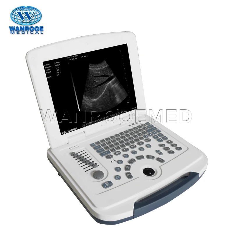 US580 Medical Laptop Portable Echography Therapeutic Ultrasound Machine