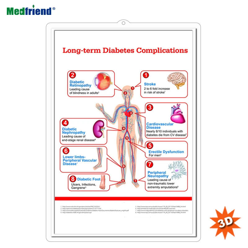 Licensed Educational Plastic 3D Medical Anatomical Wall Chart /Poster  - Long-term Diabetes Complications