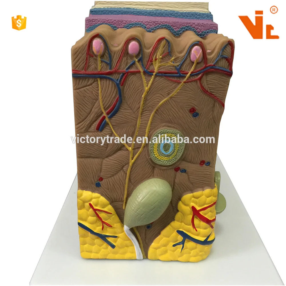 V-AM030 enlarged human psoriasis anatomical model design for teaching use