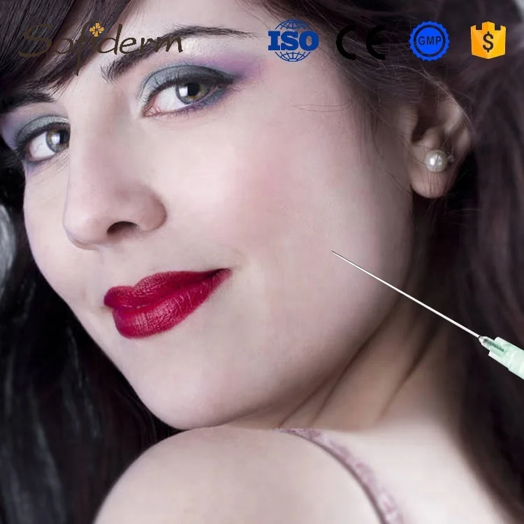 Sofiderm beauty product injectable cross linked hyaluronic acid dermal filler for cheek