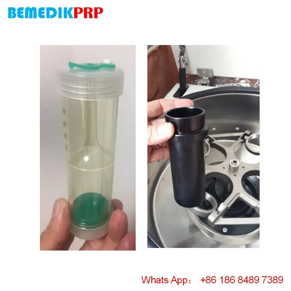 competitive price prosys prp kit and procys centrifuge manufacturer