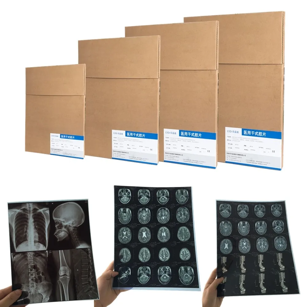 Thermal medical X-ray film for mri/cr/ct scan