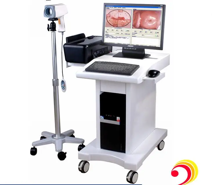 vaginal ccd camera digital video colposcope for gynecology