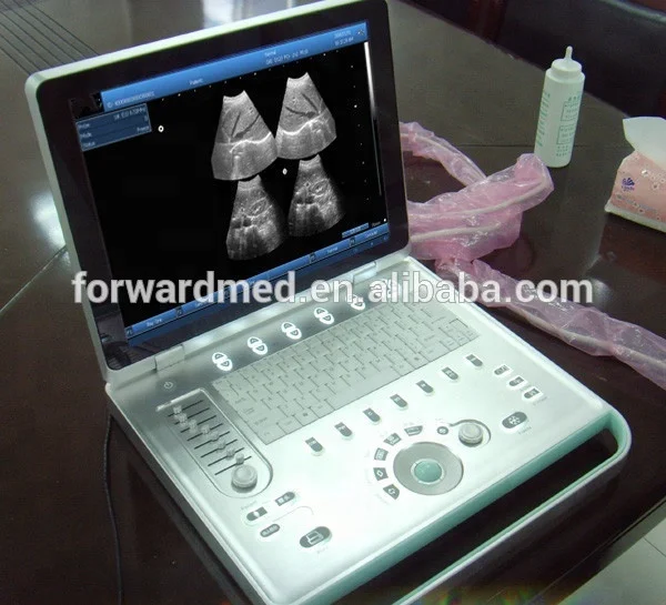 15 inch Laptop Ultrasound Machine / Portable Color Doppler Ultrasound Echo Machine