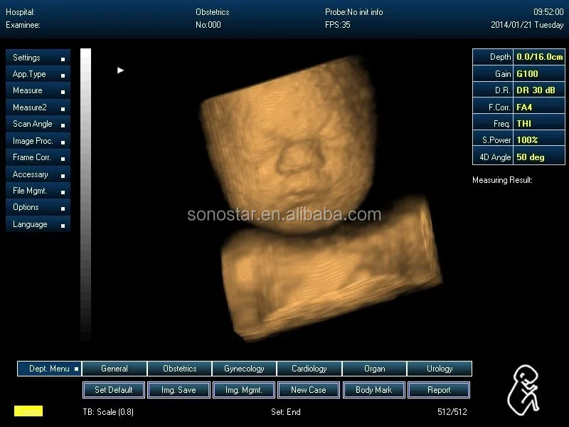 
Hot Selling 4D Portable Ultrasound Machine Price For Pregnancy Bady Monitor 