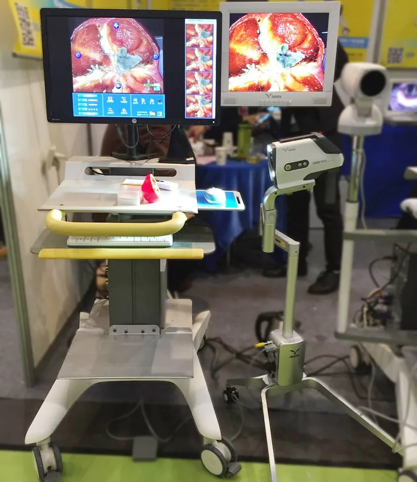 Видео кольпоскоп камеры для вагина