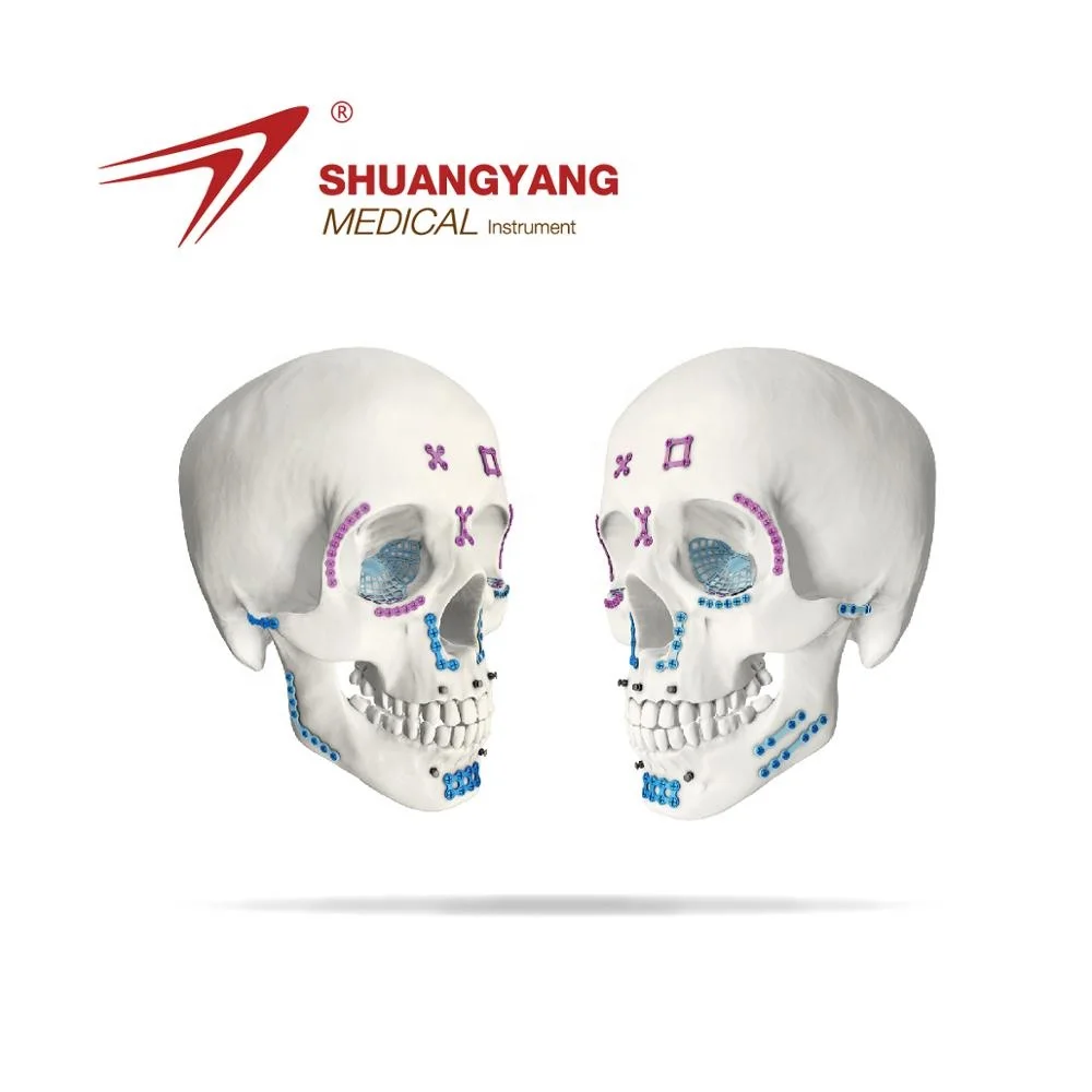 anatomical eye socket floor titanium mesh orthopedic plate large size