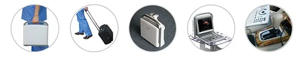  Известный бренд медицинская больница портативный цветной допплер ультразвук Chison eco