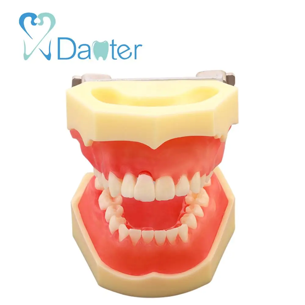 New Hot Sale Dental Periodontal Model with Removable Gingivae for Dental Practice