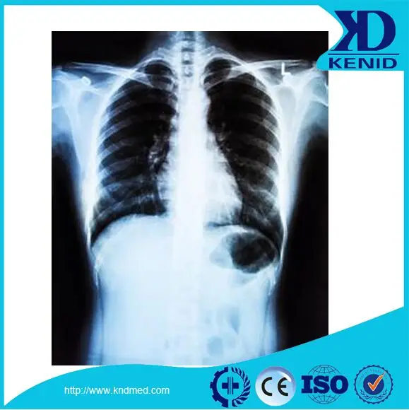 
KND A/F Dry X Ray Film for DSA/MRI Agfa Medical Fuji Diat Thermal Flim 