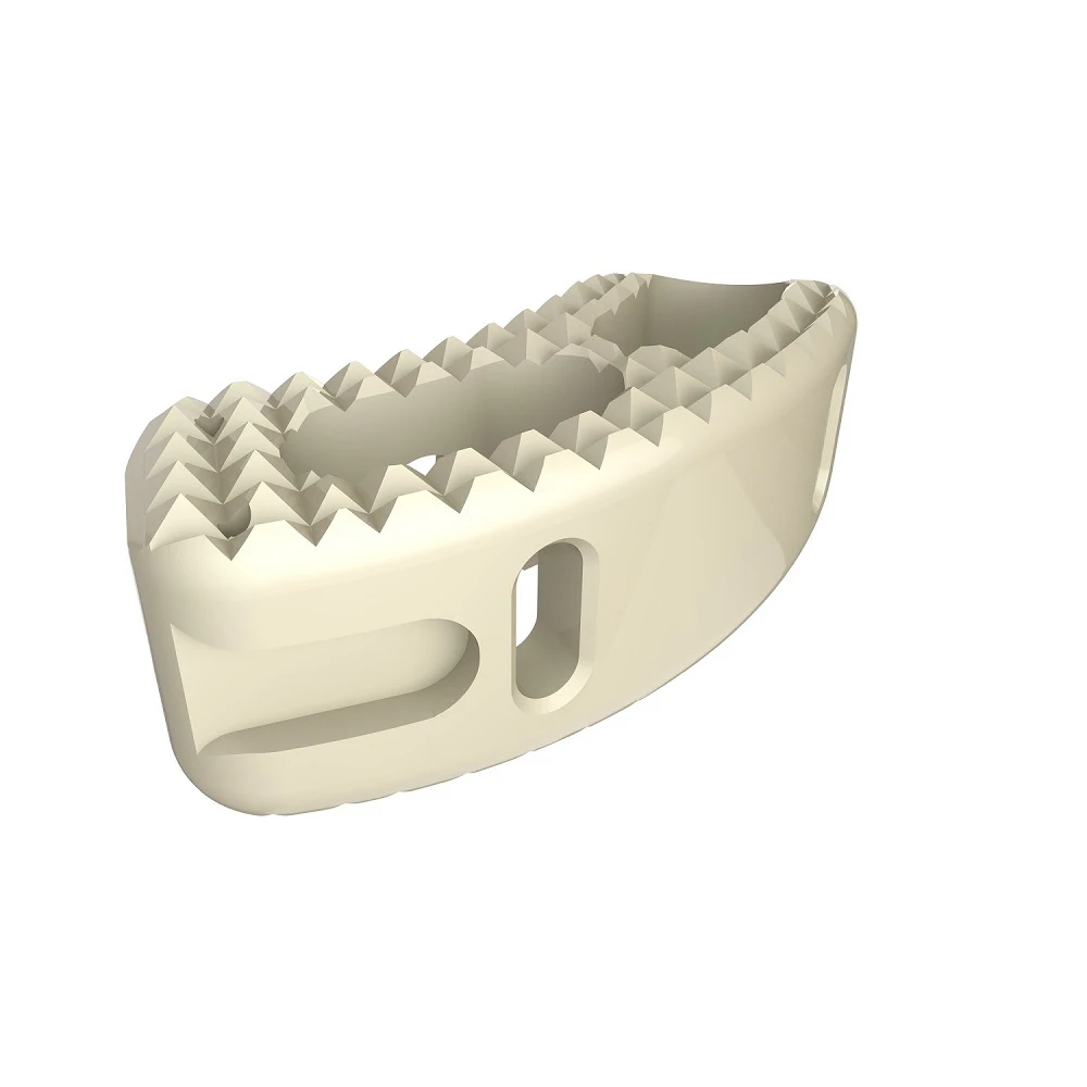 Передней шейки матки межпозвоночного блокировки клетка