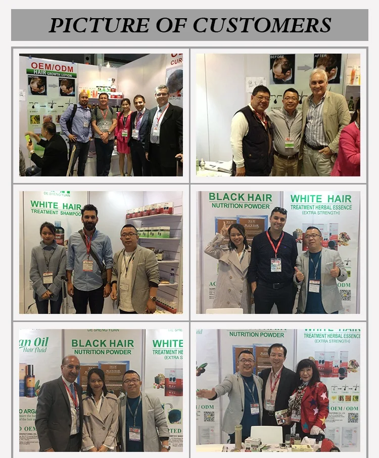 Private label hair loss products ginger shampoo for control oil