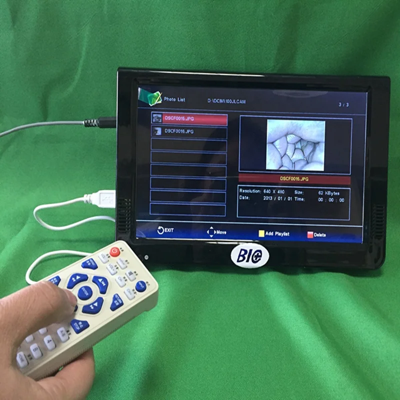 
Electronic Handheld Video Colposcope Price Colposcopy For Uterine Examination 