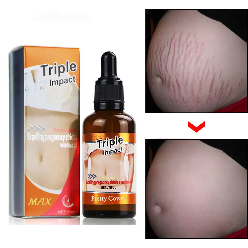 Pretty Cowry Maternity Skin Care Anti Scar Stretch Marks Removal Oil