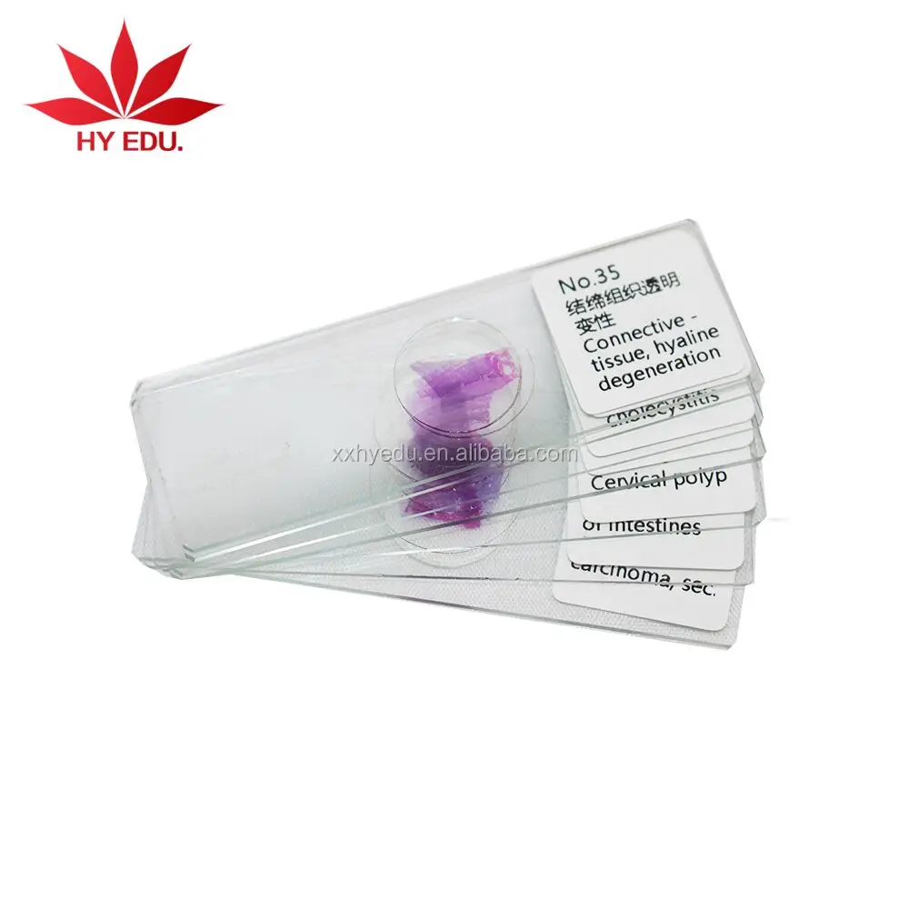 Most popular fixed set 100pcs set wooden box histology slides,human histology slides,Animal histology slides