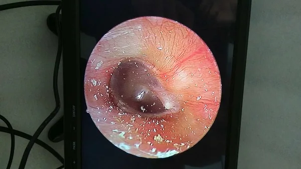 Профессиональный медицинский портативный ветеринарный эндоскоп с 10 дюймов монитор