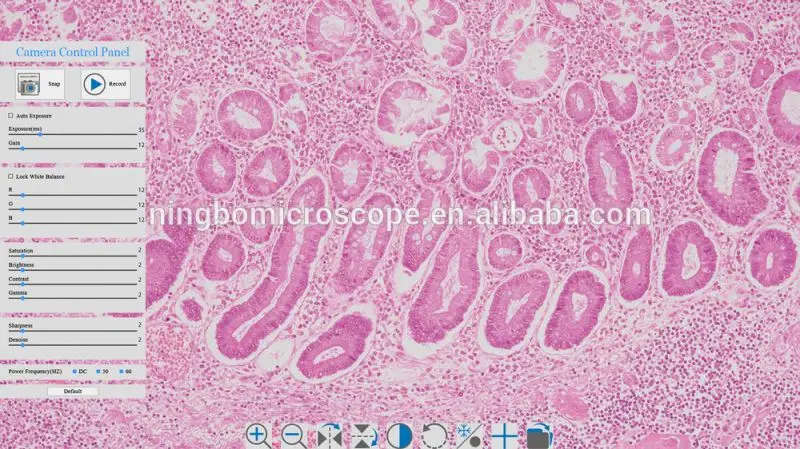 Digital Sight 1000 USB Full HD Microscope Camera