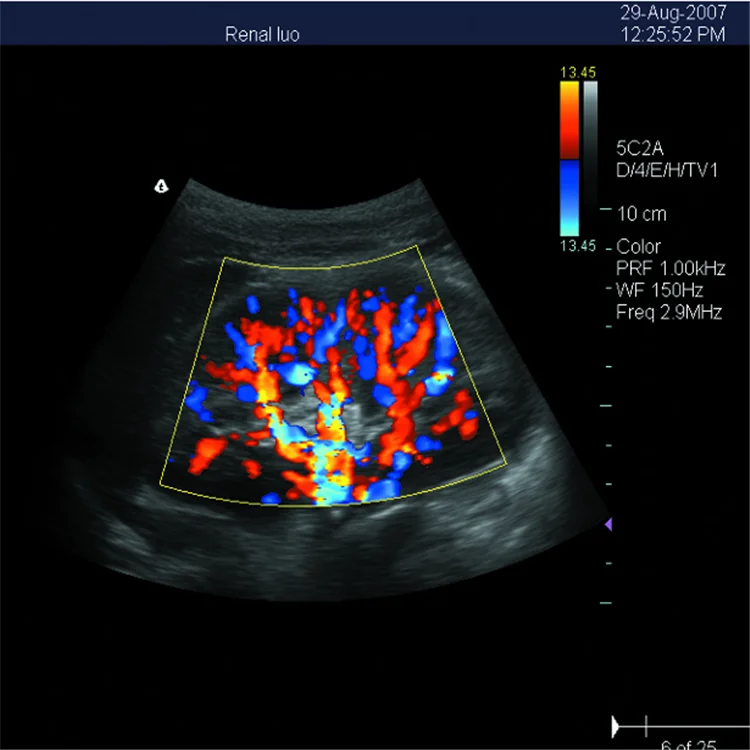 TOP-A1055 Best Scanner High Pulse Repetition Frequency Laptop Equipment Price/Medical 3d Color Doppler Ultrasound Scanner