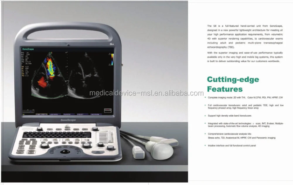 2019 Advanced Technology 4D Imaging sonoscape s8 portable ultrasound machine