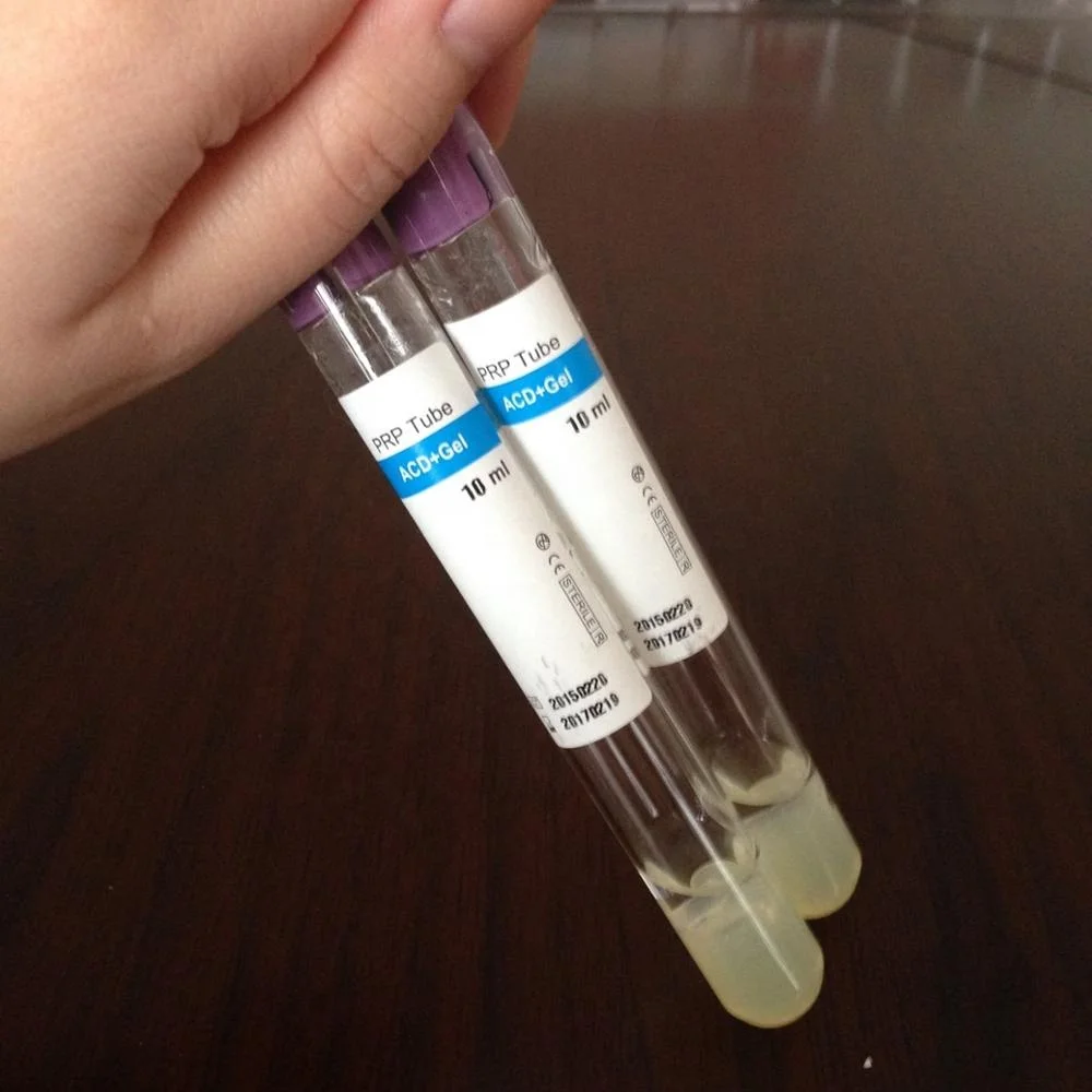 BEMEDIKPRP OEM 12ml platelet rich plasma PRP tube with ACD gel for hair loss treatment prp therapy