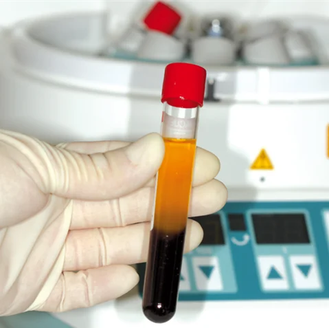 A-PRF and L-PRF tube for dental